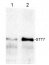 STT7 | Serine/threonine-protein kinase STT7 (chloroplastic) 